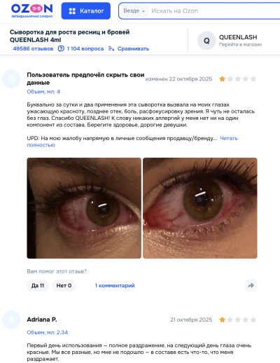 Queenlash отзывы: что скрывается за обещаниями идеальных ресниц